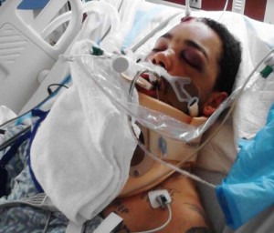 FACEBOOK PHOTO | Aaron Hartmann in a hospital bed at Stony Brook University Medical Center.