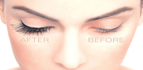 beautybaranaeli-novalash2-D